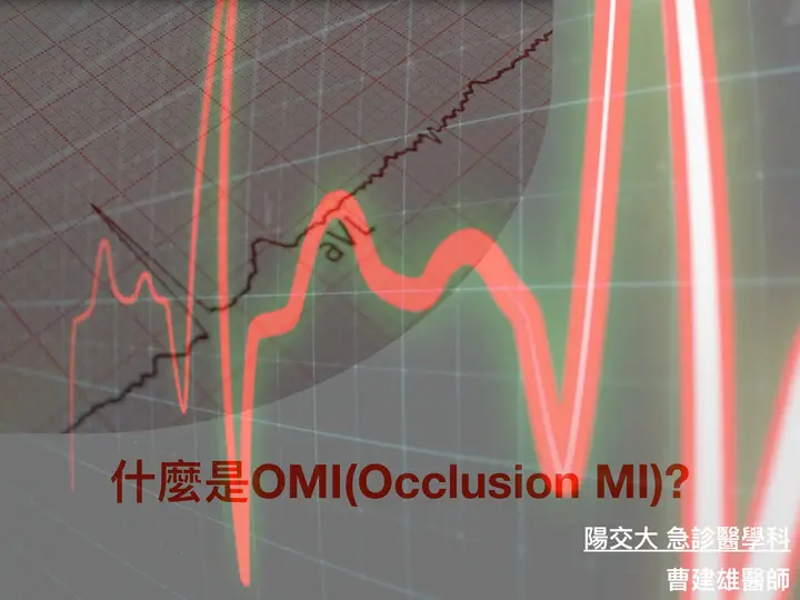 什麼是OMI?