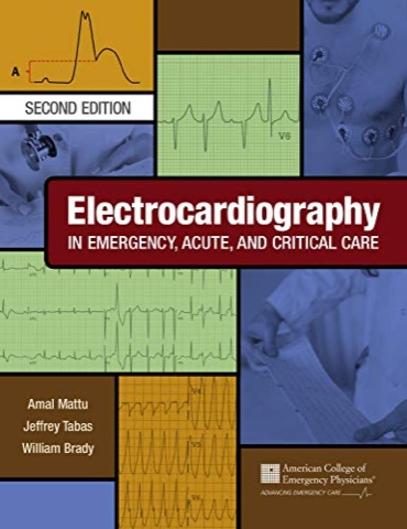 Electrocardiography in Emergency, Acute, and Critical Care