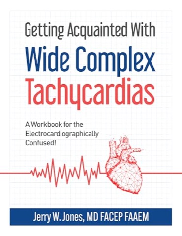 Getting Acquainted With Wide Complex Tachycardias