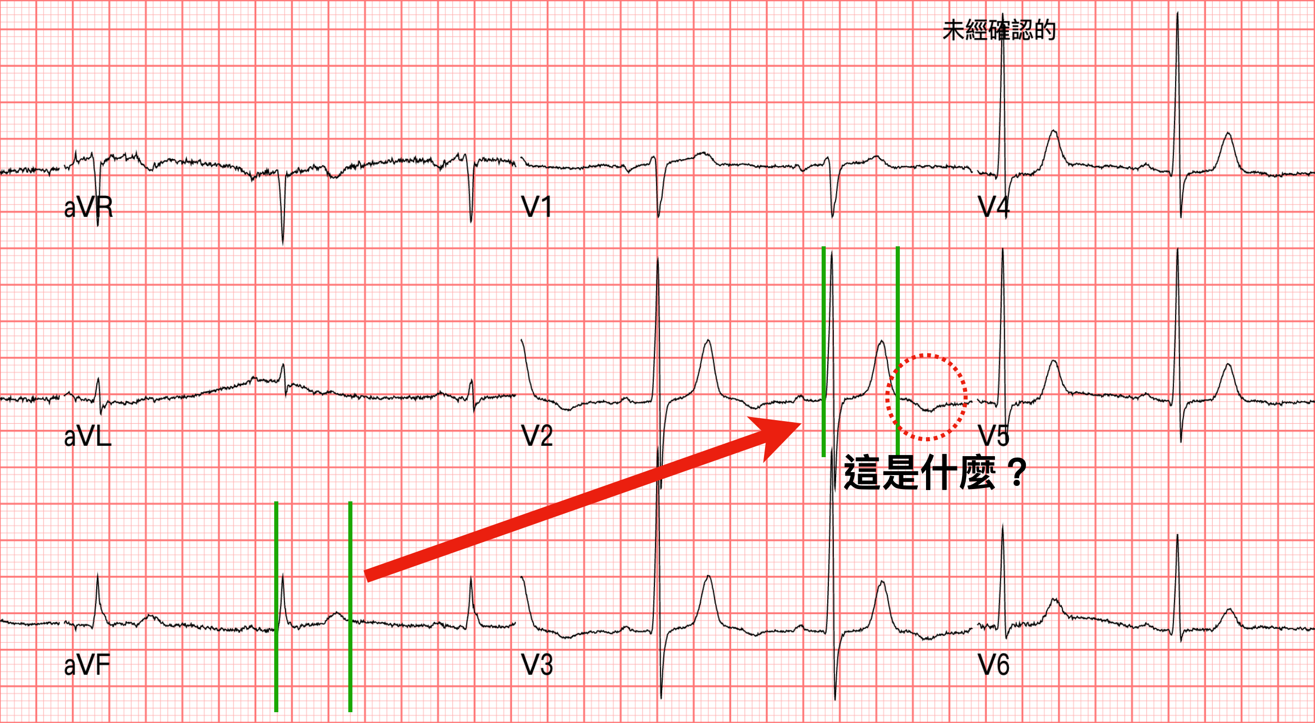 放大Fig.7