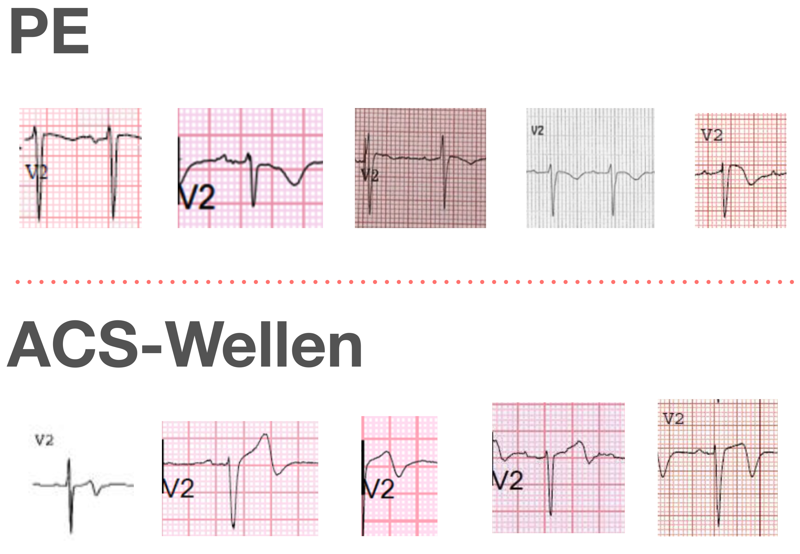 Wellen vs. PE