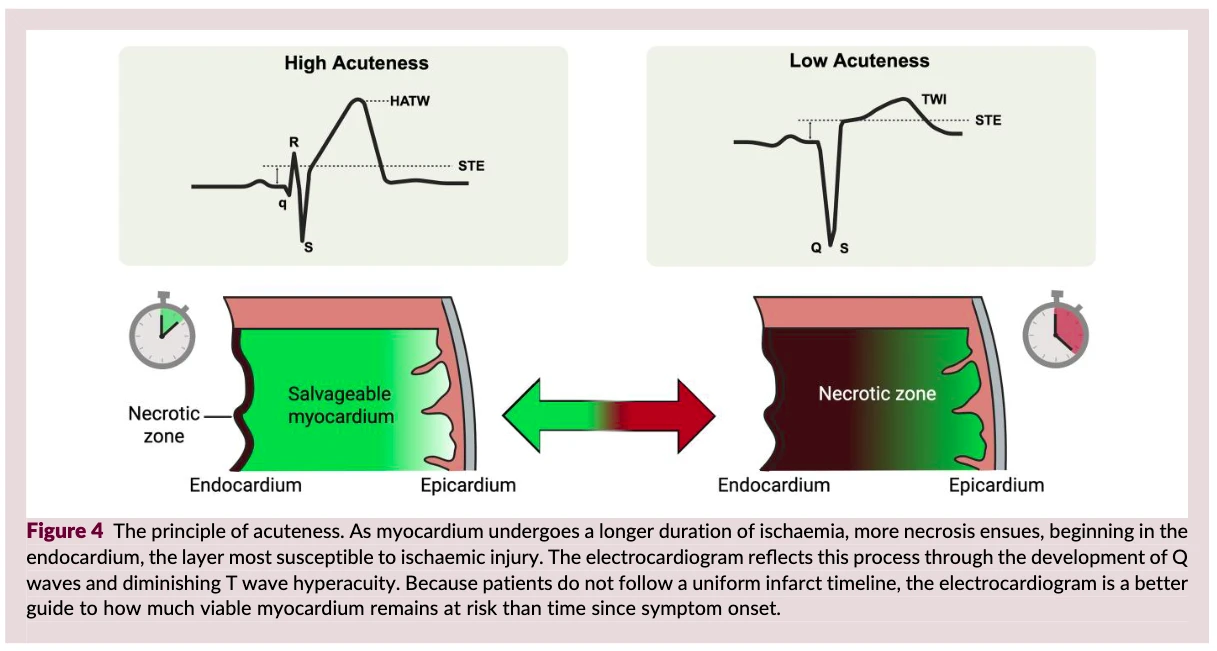 原文 Figure 4：acuteness 原理