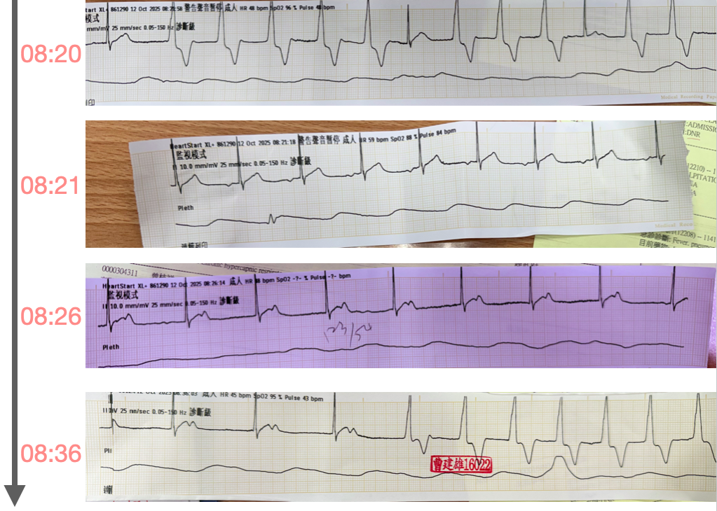 Serial dynamic ECGs
