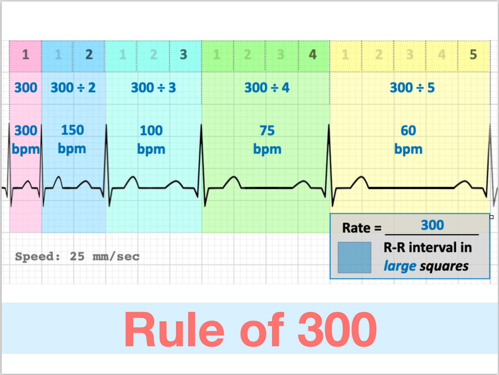 Rule of 300規則