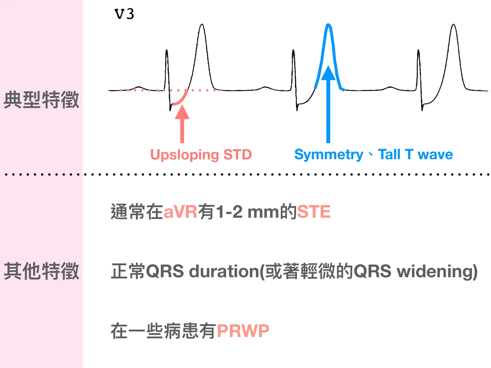 投影片左欄粉紅底，上方標「典型特徵」、下方標「其他特徵」。右上是V3導程線條示意圖，三個心跳：第一個心跳紅色箭頭標「Upsloping STD」，第二個T wave藍色箭頭標「Symmetry、Tall T wave」。下半部文字：「通常在aVR有1-2 mm的STE」「正常QRS duration(或著輕微的QRS widening)」「在一些病患有PRWP」。