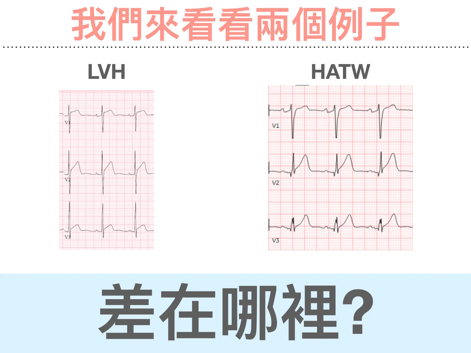 投影片「我們來看看兩個例子」：左邊是 LVH 的 V1 到 V3，右邊是 HATW 的 V1 到 V3，下方藍底大字問「差在哪裡?」