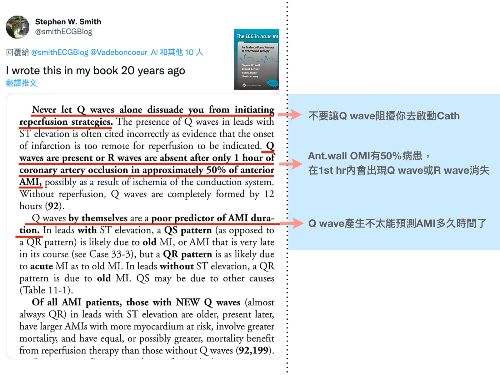 Stephen W. Smith 醫師本人的 X（Twitter）貼文截圖：「I wrote this in my book 20 years ago」，附教科書《The ECG in Acute MI》書封縮圖與內文段落（紅線標註「Never let Q waves alone dissuade you from initiating reperfusion strategies」等句）；右側是我加的三行中文重點：不要讓 Q wave 阻礙你啟動導管、前壁 OMI 在第一個小時內就可能出現 Q wave 或 R wave 消失、Q wave 很難用來推估 AMI 發生多久。